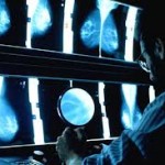 Three per cent rise over 20 years in the number of NI people with cancer