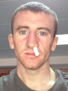 Belfast boxer Paddy Barnes missed Euro final through a broken nose