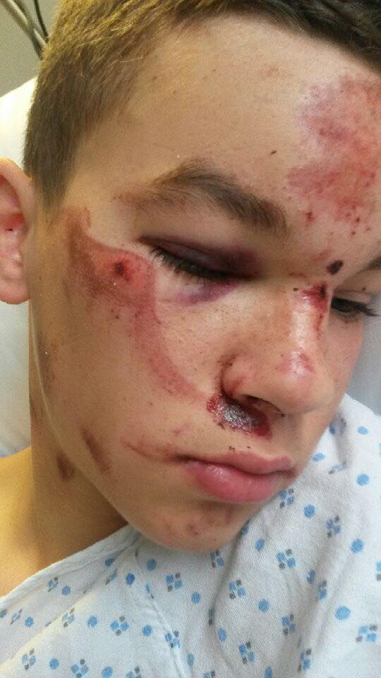 Jordan Elsie was brutally assaulted following disorder in east Belfast